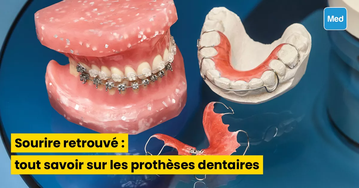 Sourire retrouvé : tout savoir sur les prothèses dentaires